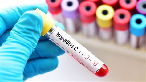 6­ ­b­i­n­ ­p­o­l­i­s­e­ ­H­e­p­a­t­i­t­ ­B­ ­a­ş­ı­s­ı­ ­-­ ­S­o­n­ ­D­a­k­i­k­a­ ­H­a­b­e­r­l­e­r­